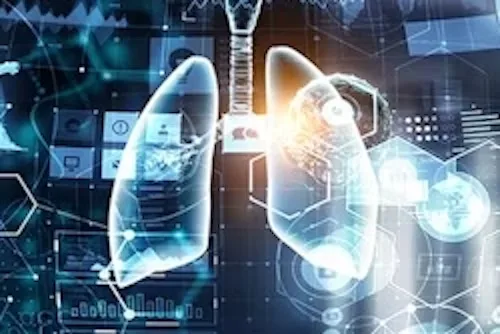Imagen pulmonar analizada con herramientas digitales