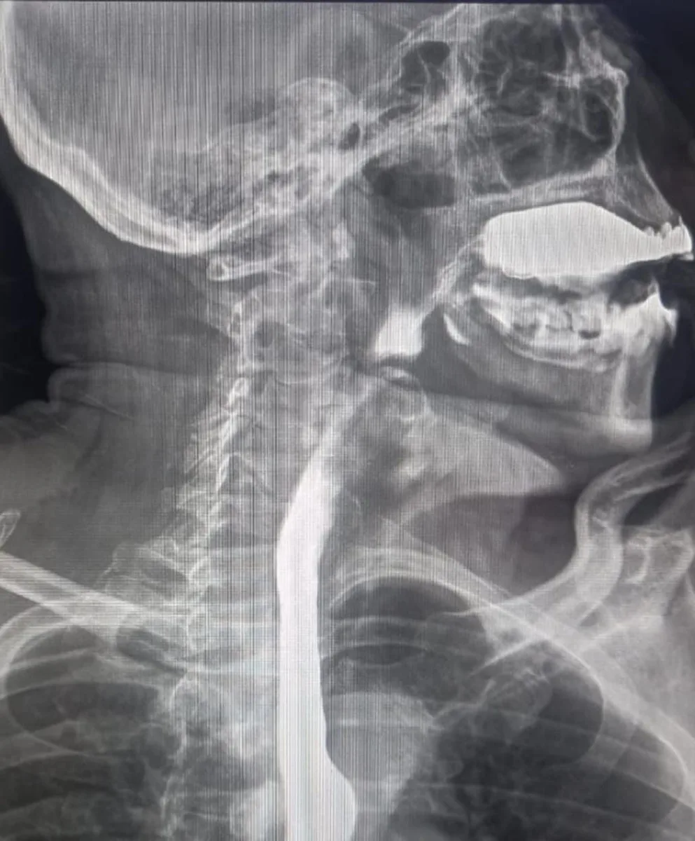 Radiografía lateral para práctica de ventana y nivel
